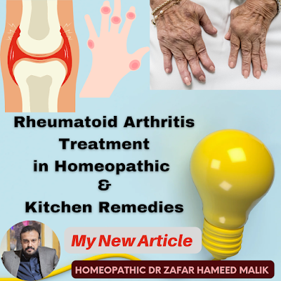 Rheumatoid Arthritis Knee Pain – Homeopathic Treatment