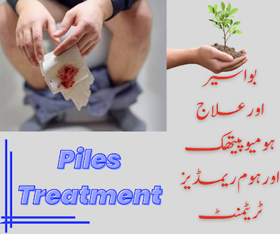 Piles Treatment-  Homeopathic and Home Remedies