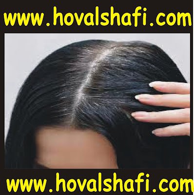 Home Remedies for Premature White Hair by Dr Zafar Hameed Malik